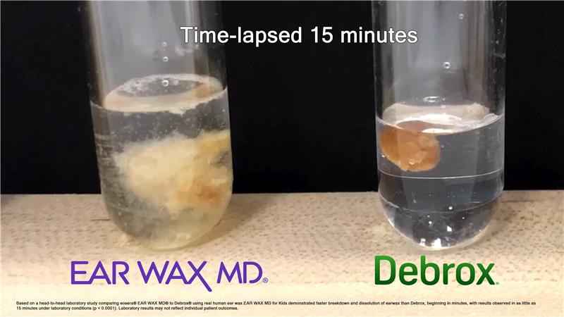 Does EAR WAX MD® work better than carbamide peroxide at getting rid of ear wax?